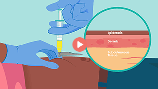Key Steps to Inject.